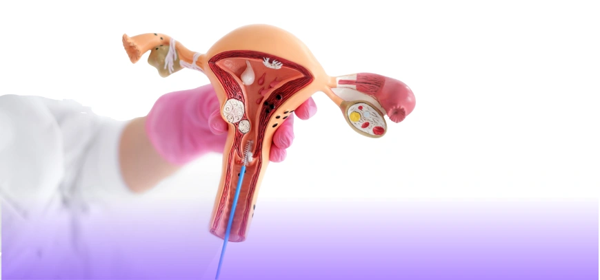 Pap smears &  Cervical cancer screening in Kalyan Nagar